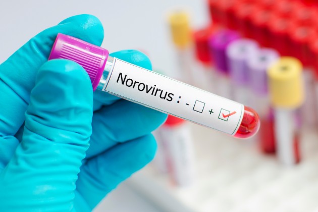 University Hospital Galway seeks the co-operation of the public to prevent spread of Norovirus